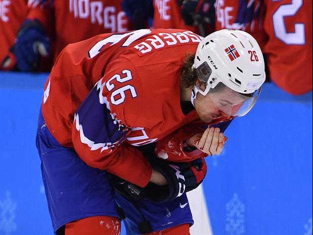Norway Hockey Player Kristian Forsberg Gets Skate To The Face During Olympic Game against Sweden.