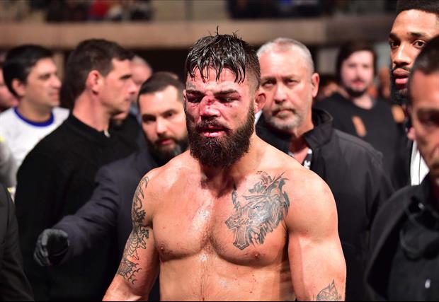 How Broken Was UFC Fighter Mike Perry's Nose After His Fight Saturday Night...